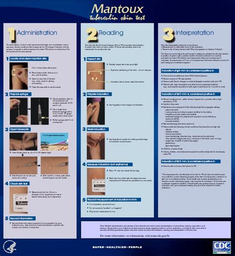 Tuberculosis PPD Skin Test: Ranges, Results, Readings .